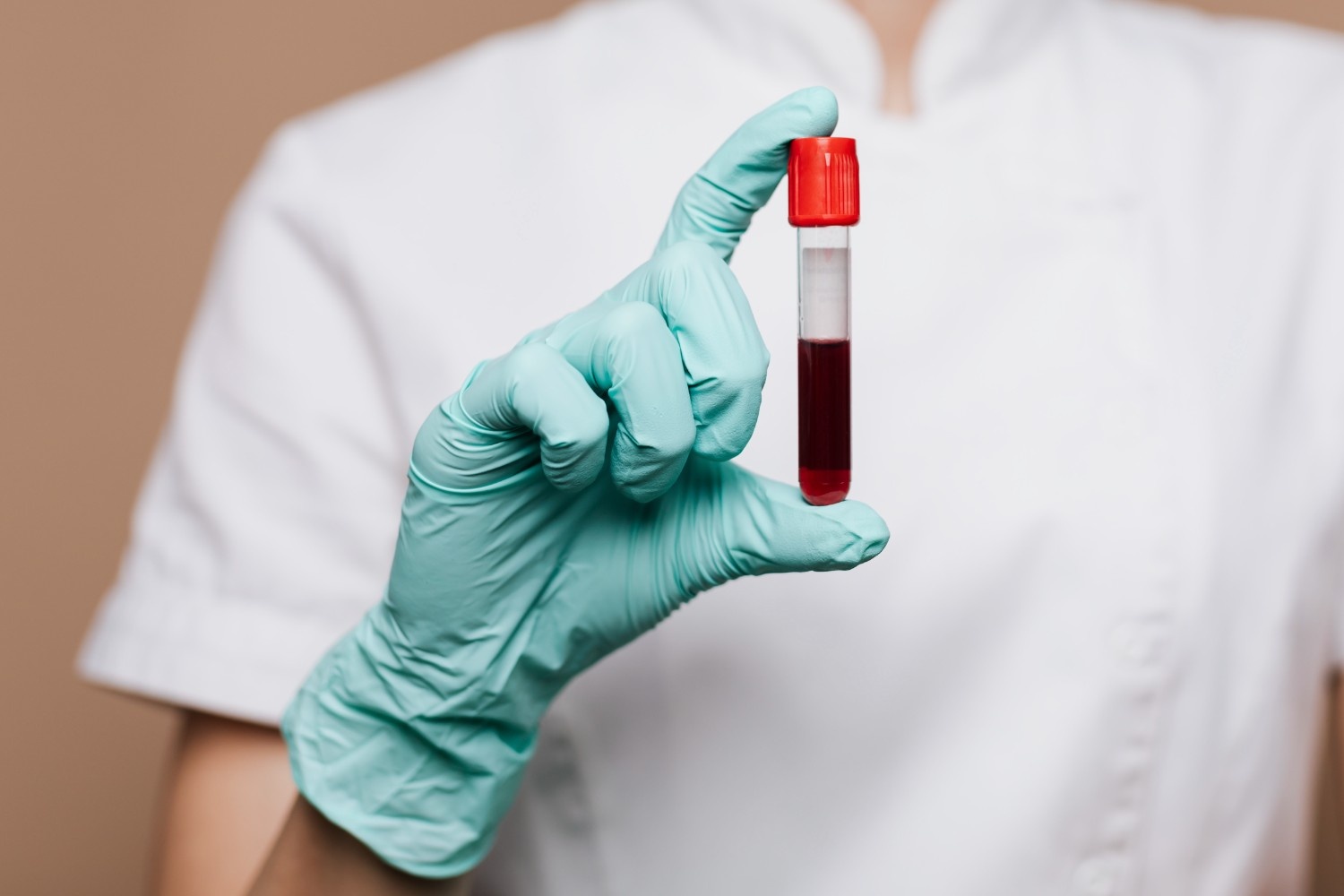 Blood Testing